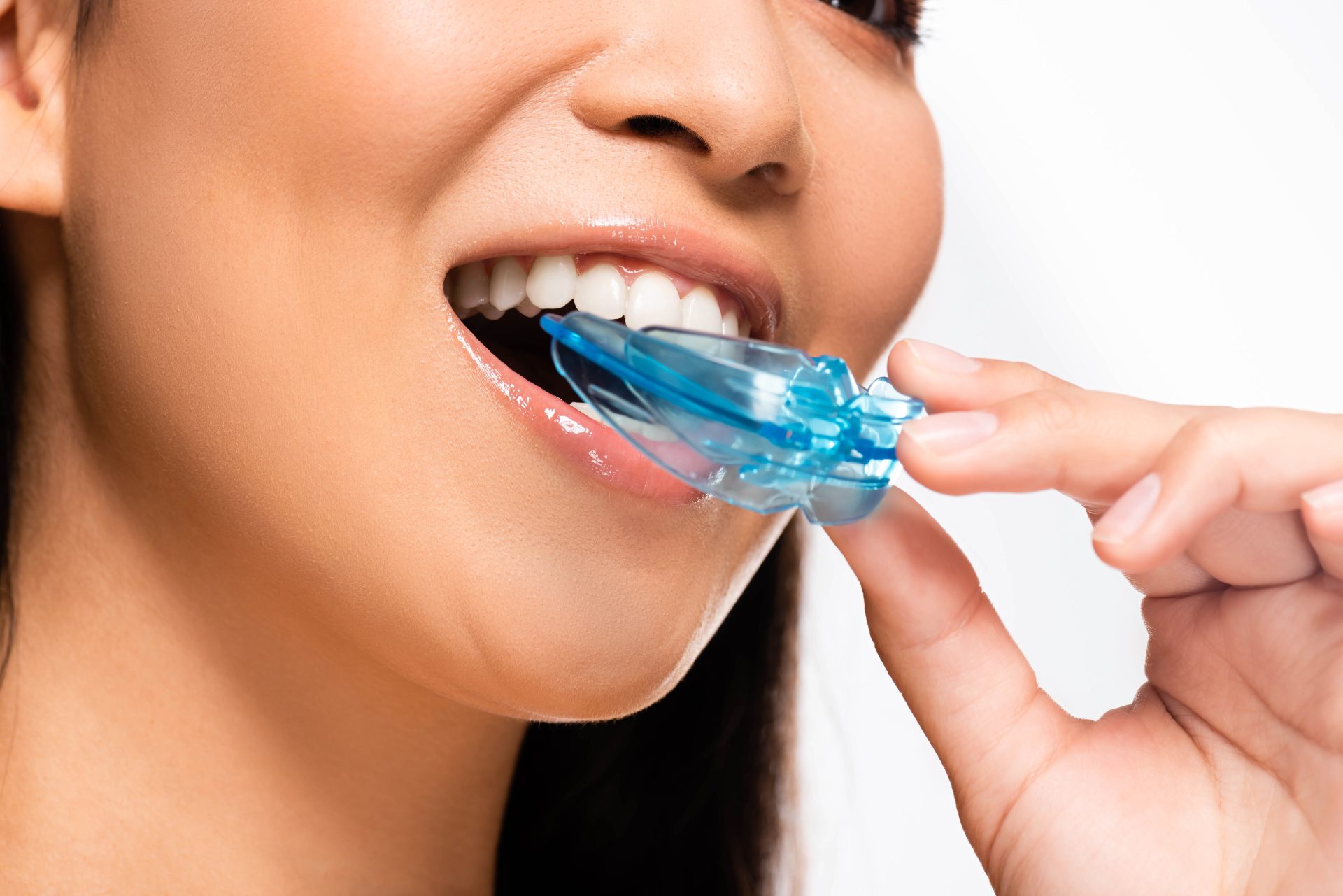 A close-up image of a woman inserting a dental appliance onto her teeth